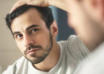 Astuces pour surmonter le complexe de la calvitie