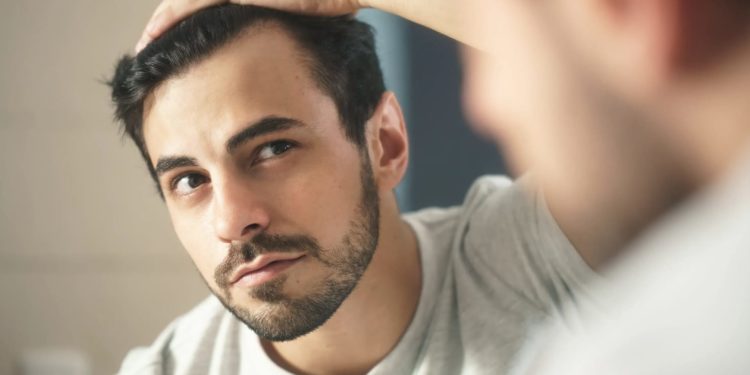 Tips to Overcome Baldness Complex